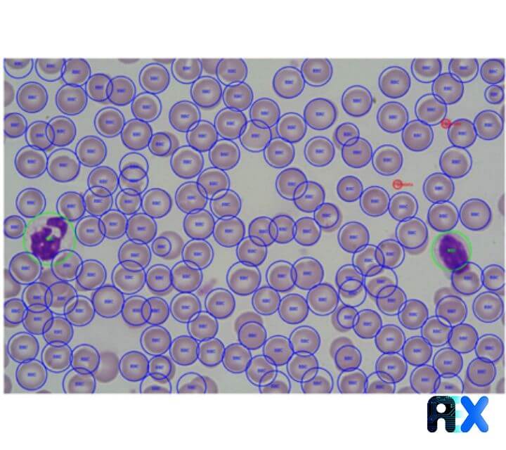 blood cell detection
