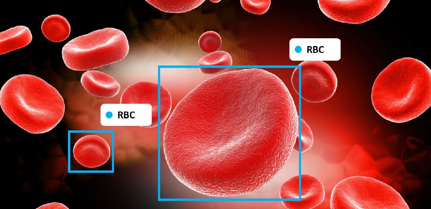 Using Computer Vision to Identify and Count Blood Cells helps in medical diagnosis